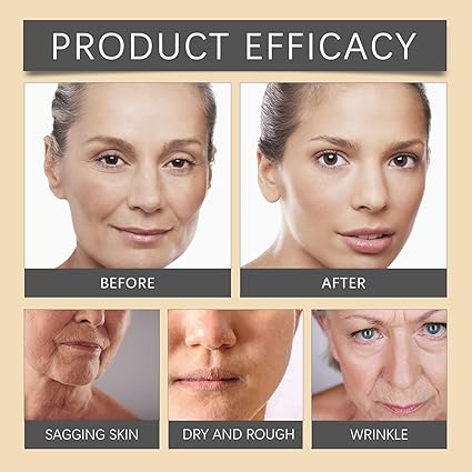 Bee Venom Botox Cream | كريم سم النحل للتجاعيد